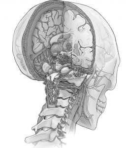 trauma op de schedel met hersenen